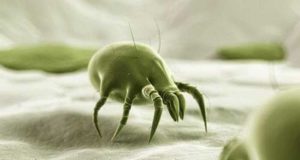 Can you See Dust Mites? Pictures, They look like, Habitat, Food & more Facts About dust mite-appearance, where they come from, signs, what they eat, gallery and harmful effects