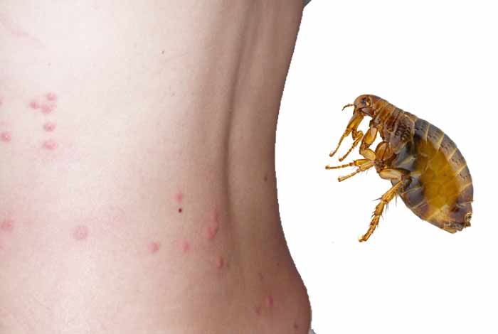 howlong do flea bites itch