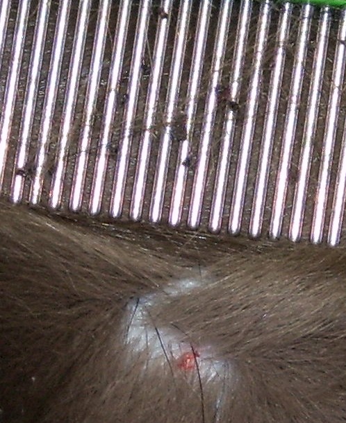 Flea bite reaction on cat skin
